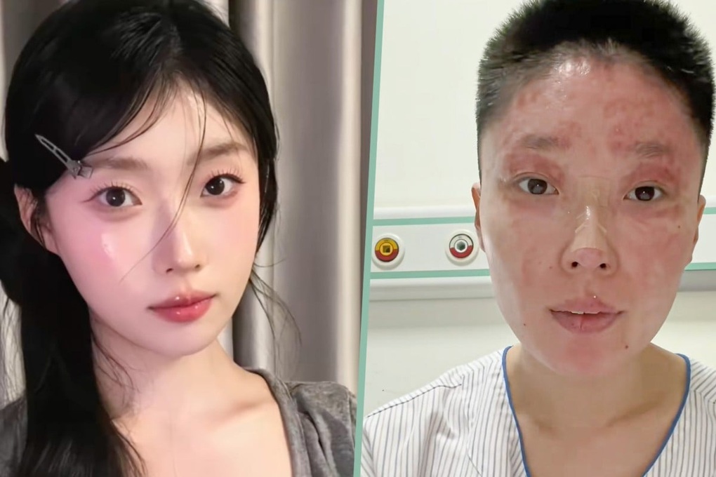 Bỏng nặng suýt mất tất cả, cựu mẫu gây sốt với nghề mới - 1